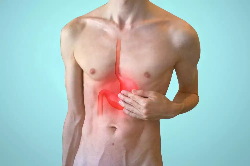 Dieta Reflux